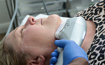 Exploring the Benefits of Dental Implants: A Permanent Solution for Missing Teeth