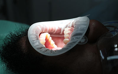 The Environmental Impact of Dentistry: Sustainable Practices at Dove Dental Spa